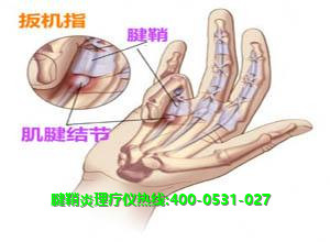 龍馬腱鞘炎理療儀