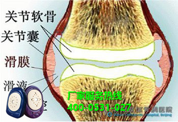 龍馬滑膜炎治療儀