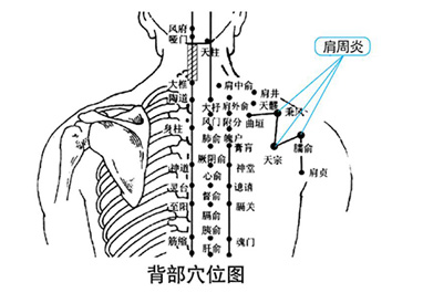 龍馬治療儀